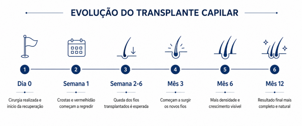 Cronograma de recuperação do transplante capilar: crescimento mês a mês