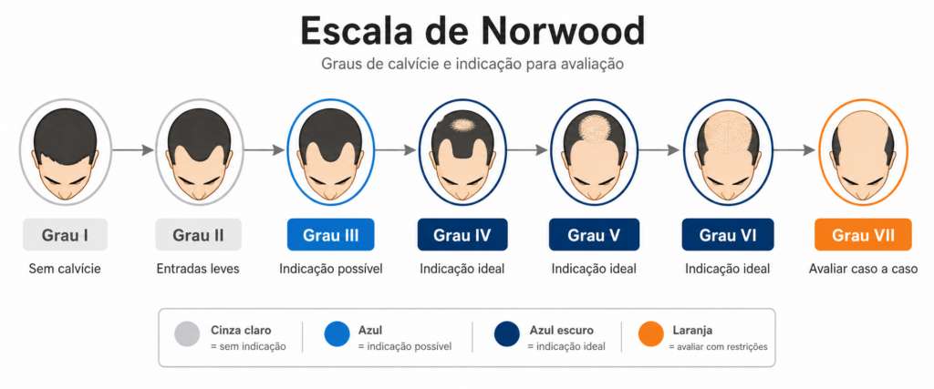 Escala de Norwood: graus de calvície masculina e indicação para transplante capilar FUE
