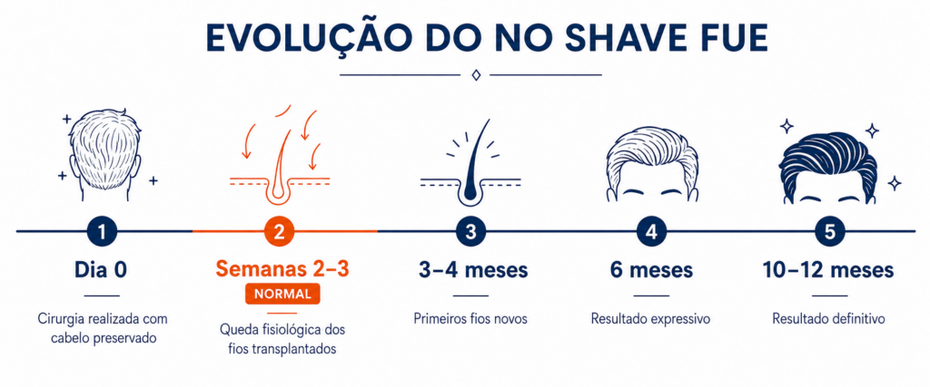 Linha do tempo de resultados do transplante capilar sem raspagem — crescimento mês a mês