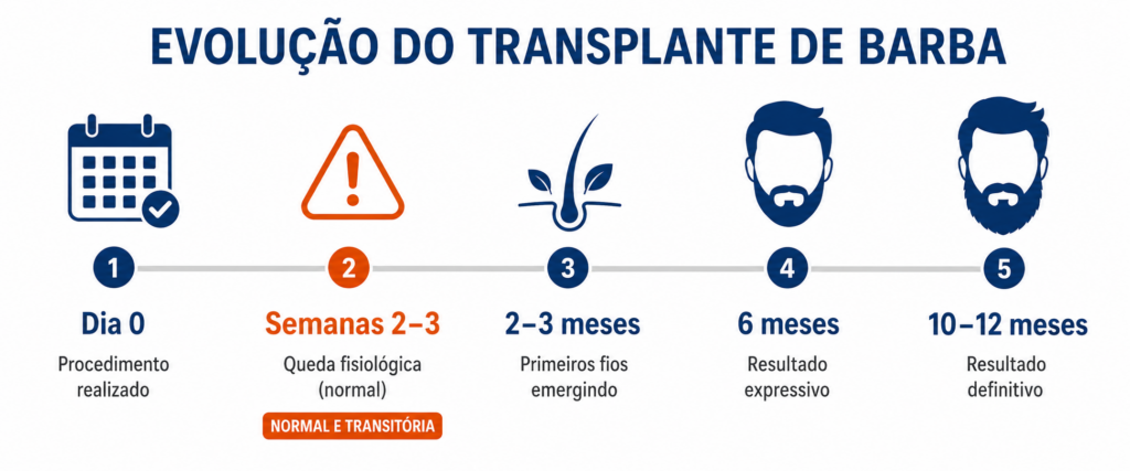 Linha do tempo de crescimento após transplante de barba — mês a mês pelo Dr. Felipe Blanco