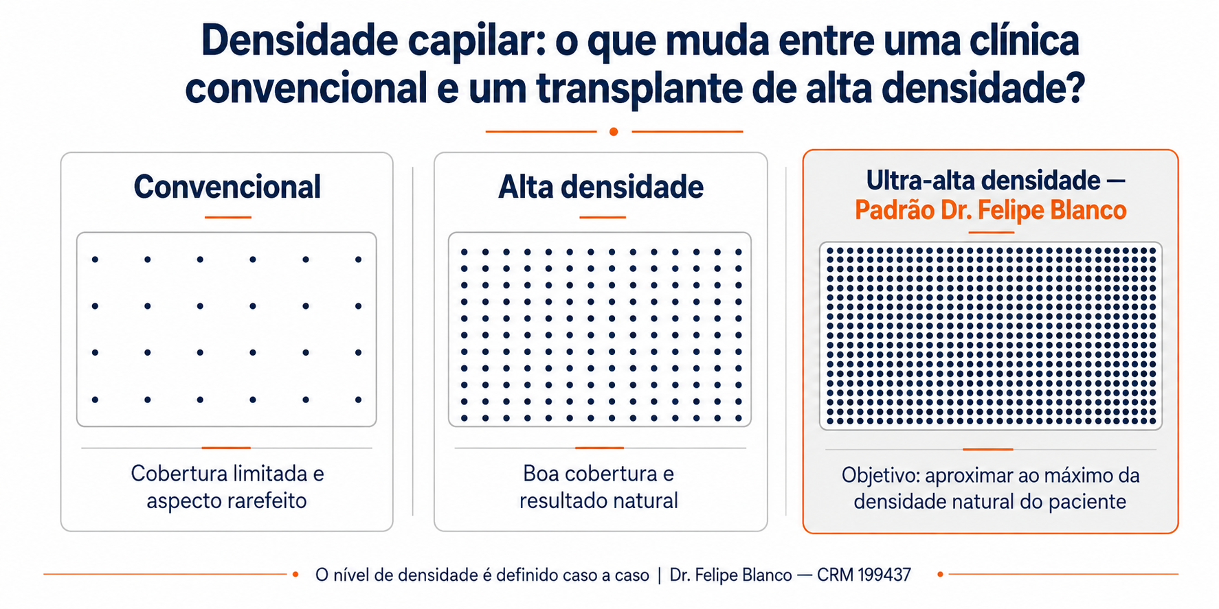 Infográfico sobre densidade capilar no transplante comparando diferentes níveis de cobertura