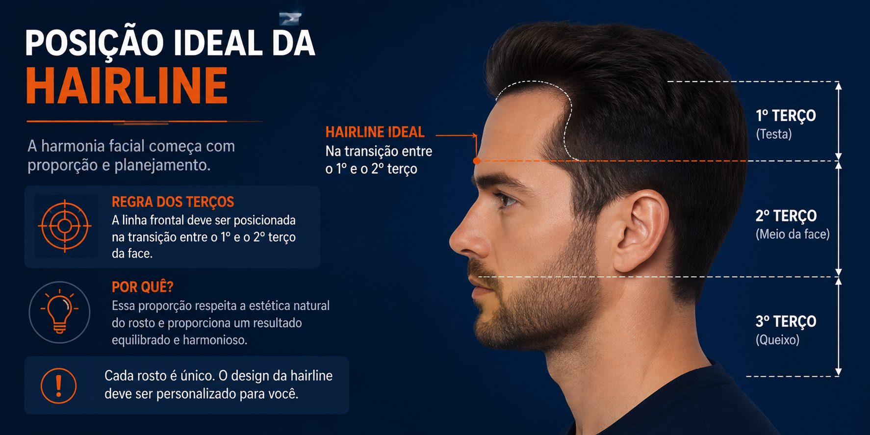Infográfico mostrando a divisão do rosto em terços faciais e o posicionamento ideal da linha de implantação capilar