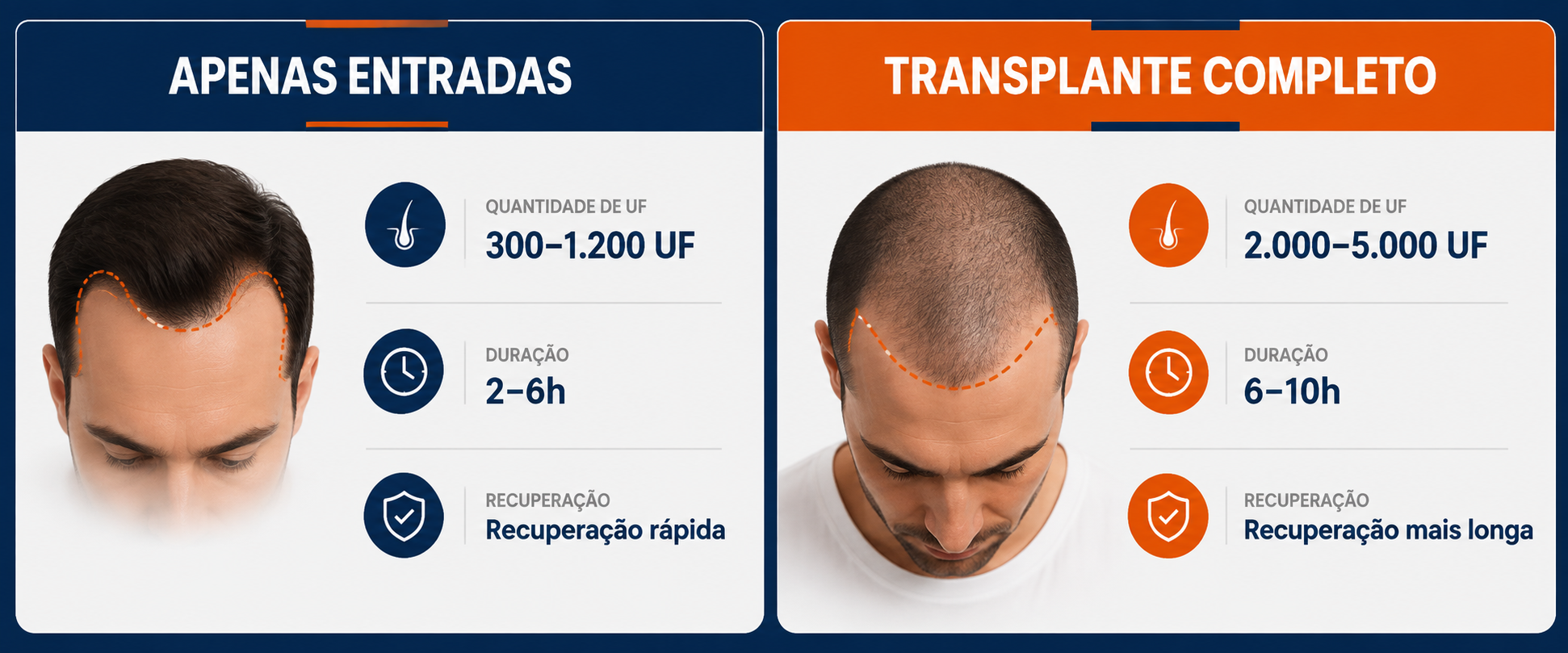 Comparativo de enxertos entre transplante capilar focado nas entradas e transplante completo