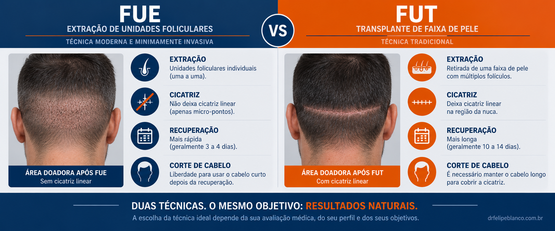 Infográfico comparativo entre técnicas FUE e FUT de transplante capilar com diferenças em cicatriz, recuperação, sedação e liberdade de corte
